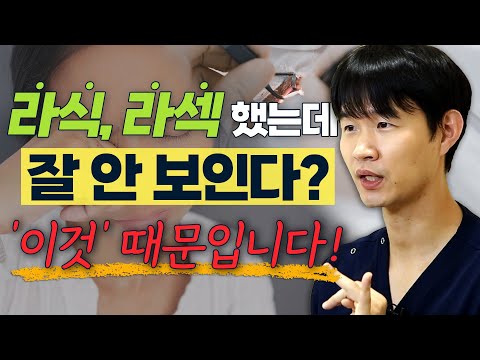 굴절 수술(라식, 라섹, 스마일) 후에 시력 떨어지는 원인과 해결법 - 솔직한 안과 #13