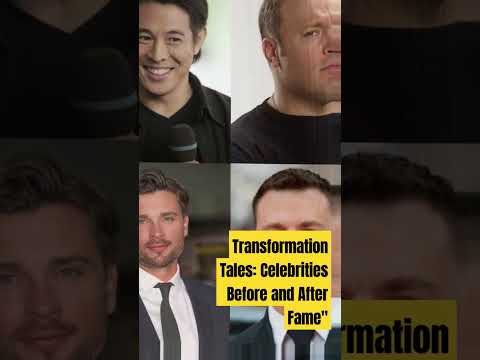 Transformation Tales: Celebrities Before and After Fame#hollywood#viral #thenandnow#legend