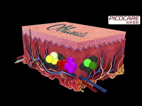 Picocare皮秒雷射 X 朵特菈診所