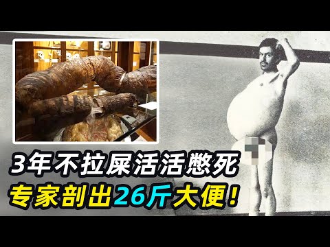 世界最长大便！小伙3年不拉屎活活憋死，大肠重达26斤