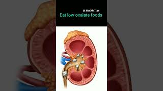 Foods for kidney stone in Tamil #shorts