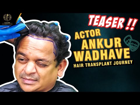 Trailer Actor Ankur Wadhave’s Hair Transformation Journey