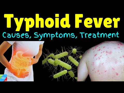 Typhoid Fever: Causes, Symptoms, Pathogenesis, Diagnosis, Treatment, Prevention and Vaccine