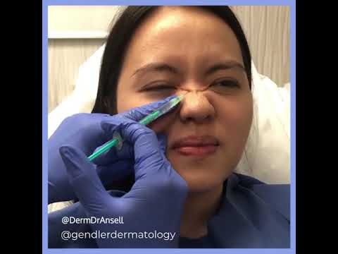 Bunny Lines I Gendler Dermatology