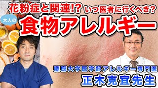 大人の食物アレルギー 原因、症状や検査、対応について【アレルギー専門医が詳しく解説】