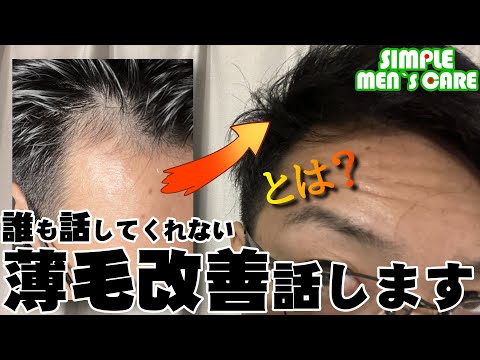 驚くほどスグに髪の毛が増える裏ワザ【薄毛/AGA/ハゲ治療】