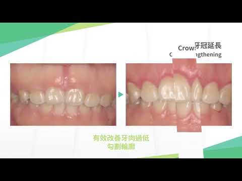 PolyDental 健滙牙科 服務一覽