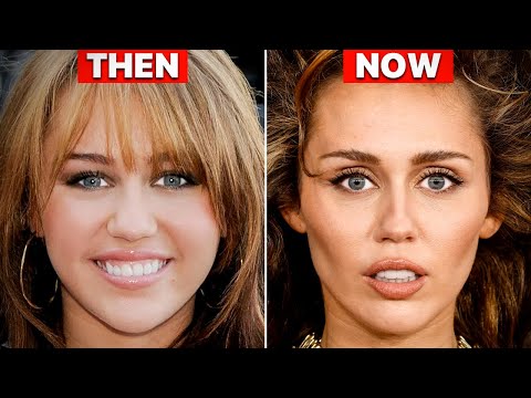 Miley Cyrus NEW Look 2024 Plastic Surgery Analysis