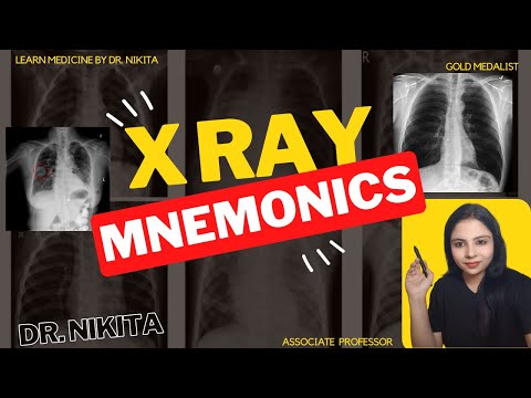 X Ray Mnemonics | Chest X Ray Tricks for reading| X-Ray film in Hindi | Dr. Nikit @solutionpharmacy