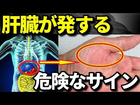 肝機能が低下し肝臓が悲鳴を上げているサイン７選！肝臓疲労で現れる前兆・症状とは？知ってよかった健康雑学