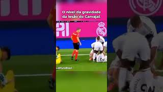 O nível da gravidade da lesão do Carvajal. #realmadrid #futebol #futebolaovivo #flamengo #carvajal