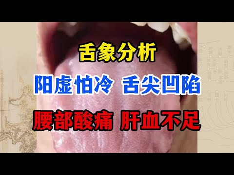 舌象分析：阳虚怕冷，舌尖凹陷，腰部酸痛，肝血不足