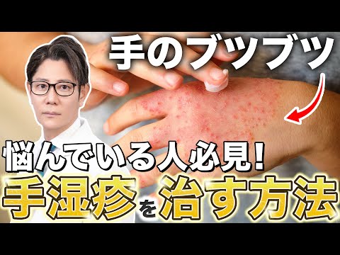 【意外な原因も】手荒れや手の痒み｜手湿疹を治す方法を解説