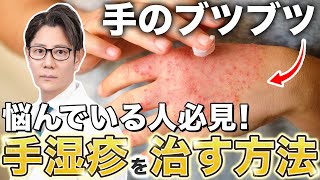 【意外な原因も】手荒れや手の痒み｜手湿疹を治す方法を解説