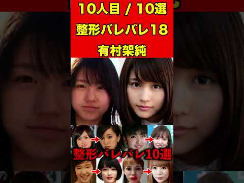 有村架純18整形がバレバレな芸能人！10選 #芸能界の闇 #ゴシップ #整形 #芸能人 #噂話 #有名人  #雑学 #モデル #芸能 #女優 #アイドル #美容