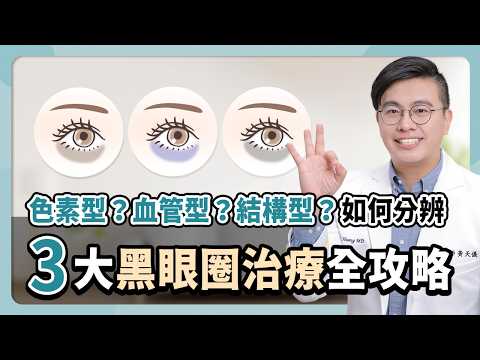 醫美專家揭露黑眼圈消除秘技！黑眼圈的4大致命敵！你中招了嗎？教你如何消掉黑眼圈~ #黑眼圈 #醫美 #皮秒雷射 #5d亮睛術