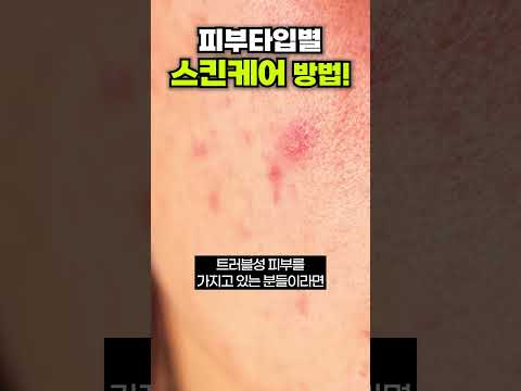 피부타입별 스킨케어방법!