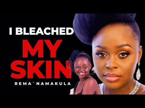 Rema Namakula and the Grand Masters of Skin Bleaching