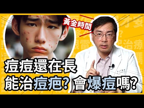 痘疤越早治療越好？痘痘還在長，可以治痘疤？會爆痘嗎？皮膚科林政賢醫師來告訴你把握痘疤治療黃金時間！