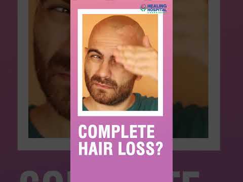 गंजेपन से मुक्ति के उपाय | Hair Transplant Ideal Candidate #hairtransplant