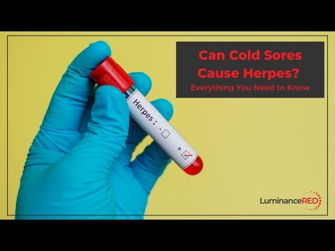 Can Cold Sores Cause Herpes? Everything You Need to Know