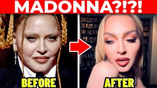 Plastic Surgeon: MADONNA's Cosmetic Surgery Transformation!