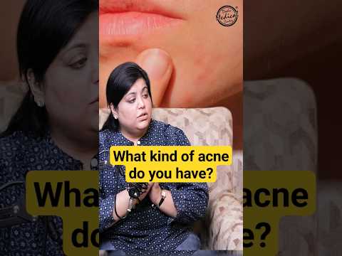 Hormonal Acne Treatment #acne #skincare #dermatologist #shorts