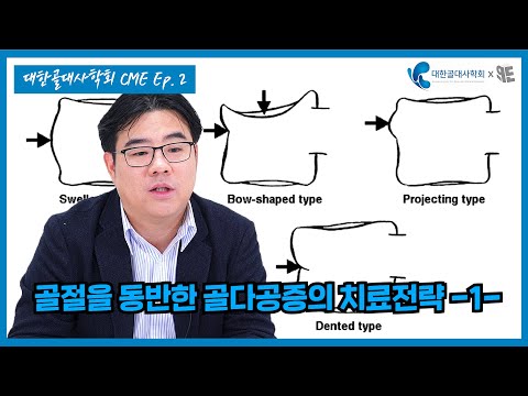 [대한골대사학회x청년의사 CME ② ]고령층 골절, 이 신호를 놓치면 안됩니다