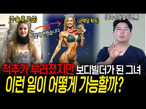 운동하다 척추가 부러졌지만 보디빌더가 된 그녀, 이런 일이 가능할까? | 의학 전문채널