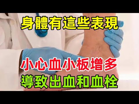 警惕！當身體有這些表現時，小心血小板增多導致出血和血栓#健康常識#養生保健#健康#健康飲食