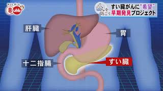 がんを防ごうー2018年5月31日放送 生存率80％へ！すい臓がんを「ステージ0」で発見～早期診断プロジェクトとは？