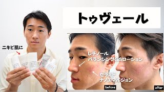 【脂性肌・ニキビ肌】トゥヴェールのスキンケアが完璧すぎる…レチノールからバランシングgaローション、ナノエマルジョンまで徹底比較！