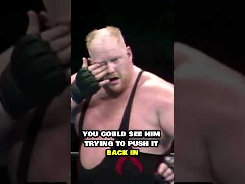 Vader's Eye Popped Out During A Fight!