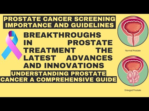 Prostate cancer screening importance and guidelines | Understanding Prostate Cancer Guide