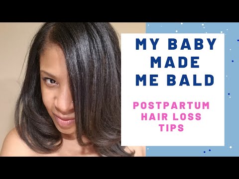 My Baby Made Me Bald | Postpartum Hair Loss Tips