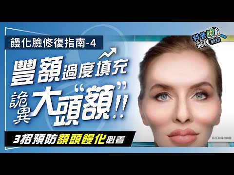 饅化臉修復指南-4｜豐額過度填充詭異"巨額"外星人現蹤！  面部解剖學大師公開：額頭饅化避險3大秘訣 科普醫美新知360-20240830