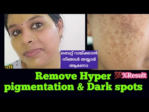 Remove dark  spot Hyper pigmentation/Tan/Get clear glowing skin/#renuhoneyrose #hyperpigmentation