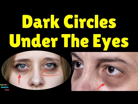 Dark Circles Under The Eyes: Causes & Treatments | How To Get Rid Of Dark Circles