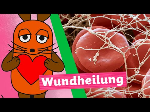 Wie heilt eine Wunde? | Die Maus | WDR