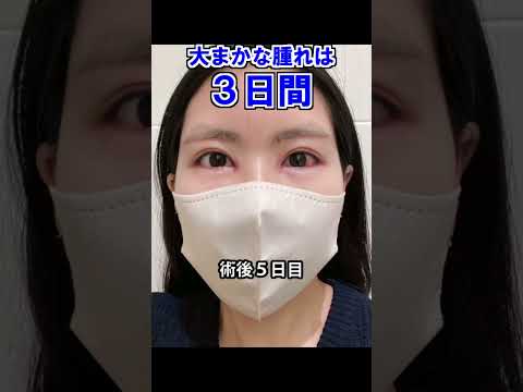 ※リアルなダウンタイムを公開※20代女性の眉下リフト&目の上切開！