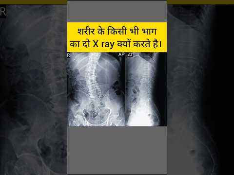 शरीर के किसी भी भाग का दो X ray क्यु करते है? #anatomy