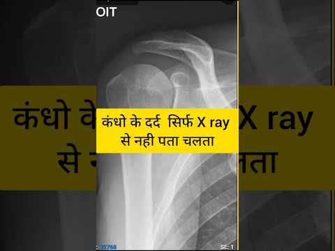 Shoulder Pain Need MRI Scan #anatomy