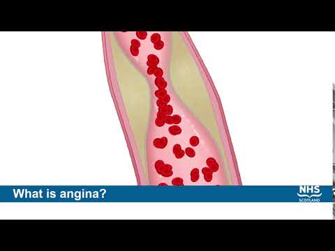 Atherosclerosis and Coronary Artery Disease