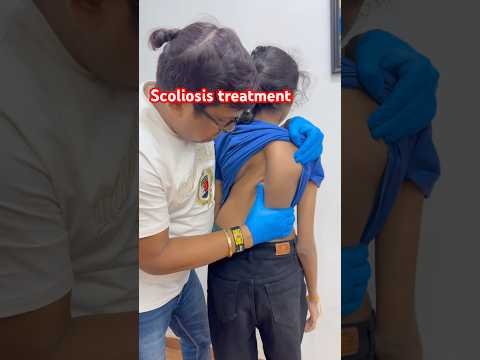 Scoliosis treatment #drrajneeshkant #worldfamouschiropractor