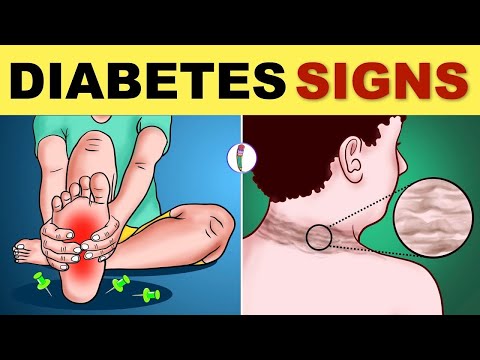 8 Prediabetes Signs You Must Know Before It's Too Late