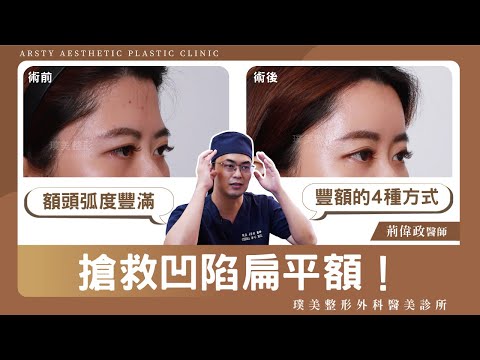 搶救凹陷扁平額！讓額頭弧度更好看，豐額的4種方式#璞美#荊偉政醫師