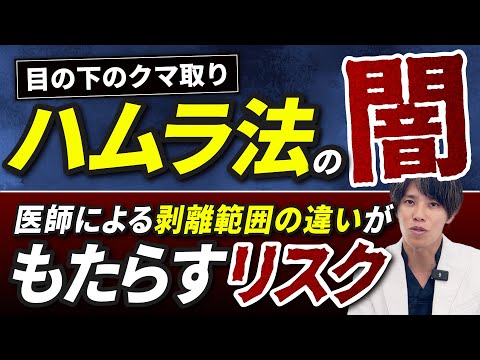 【クマ取り】裏ハムラの闇！医師による剥離範囲の違いがもたらすリスクと医師選びの重要性、理想の治療を実現するには？【裏ハムラ・表ハムラ】