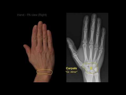 Anatomy of Hand X-rays_Revised