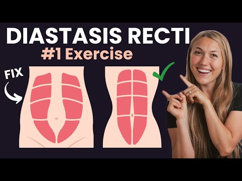 BEST Diastasis Recti Exercise To Strengthen Core - Postpartum Fitness Specialist