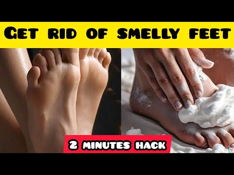 Smelly Feet Remedy| How to Remove Feet Odor| Get Rid of Feet Smell | Smelly Feet Cure #smellyfeet